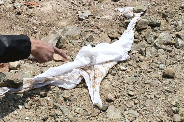 Sokak Köpekleri, 82 Yaşındaki Kadını Parçalayarak Öldürdü