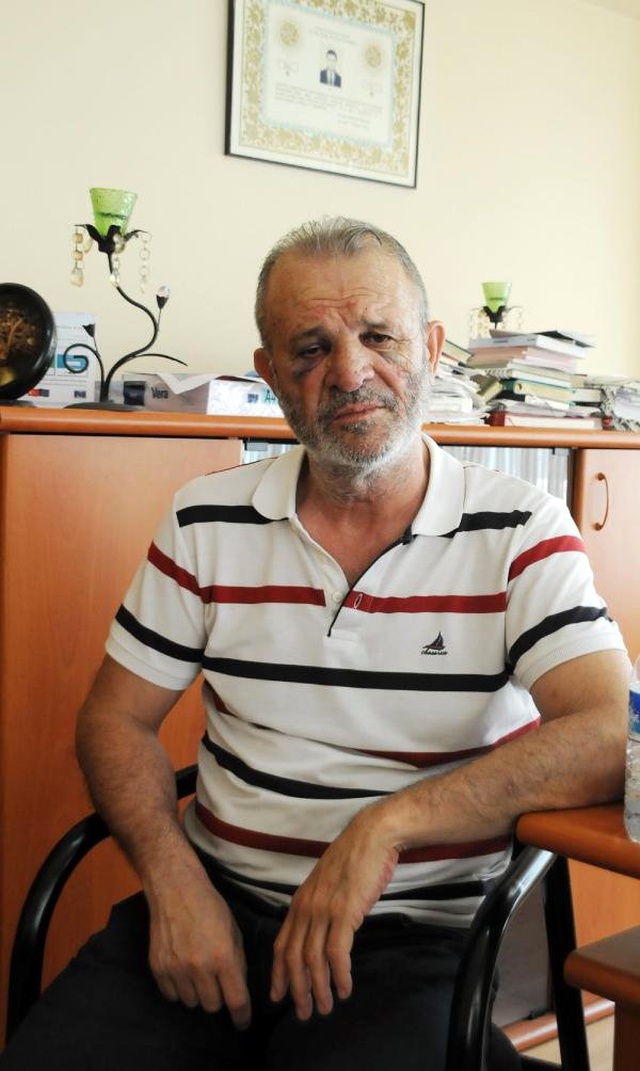 Ücretini isteyen avukat, magandalar tarafından tekme tokat dövüldü