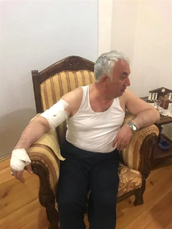 Arpaçay Belediye Başkanı, köpek saldırısında yaralandı: Beni parçalamaya çalıştı