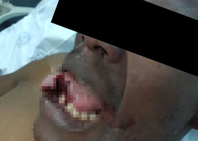 Kadın doktor tecavüzden saldırganının dilini kopararak kurtuldu