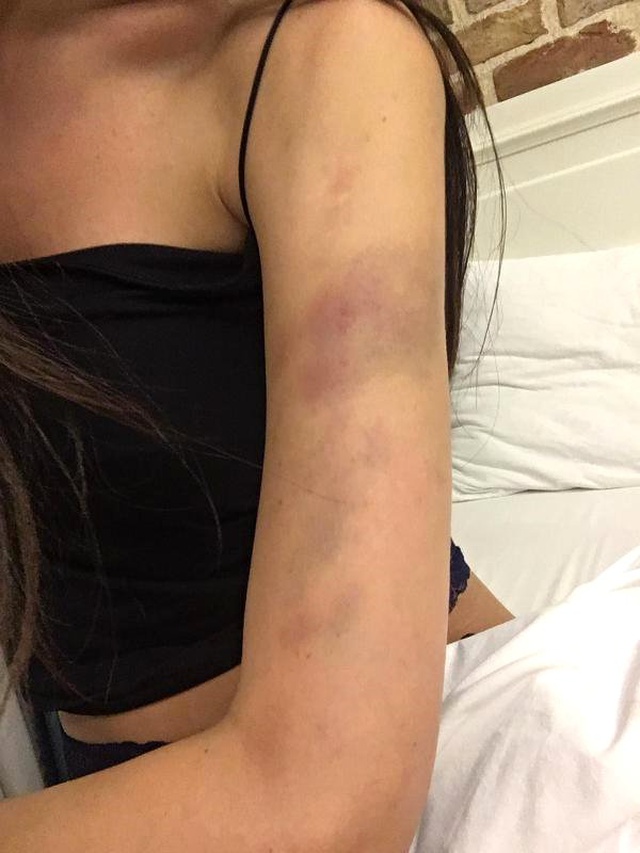 Ortaköy'de dehşeti yaşayan Sırp model, sevgilisinden kaçıp polise sığındı!