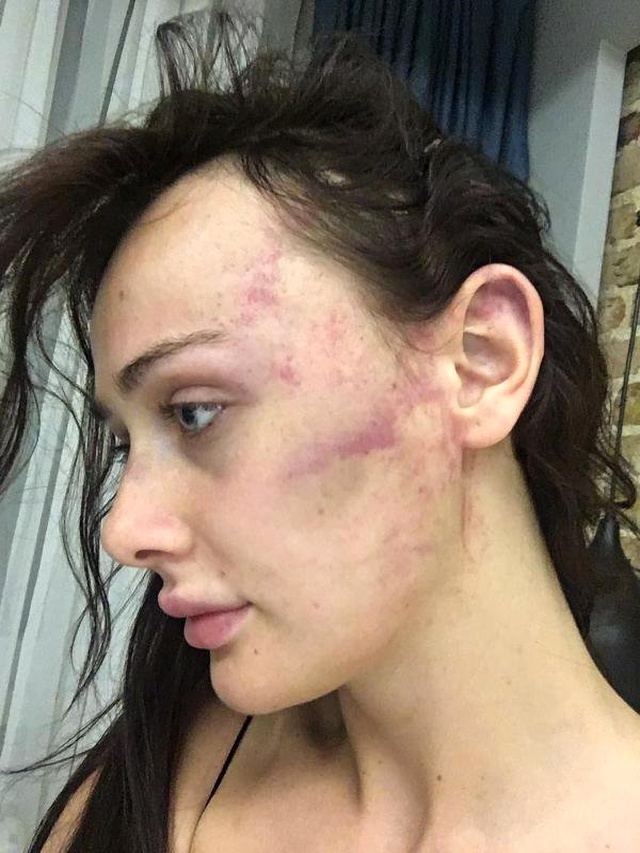 Ortaköy'de dehşeti yaşayan Sırp model, sevgilisinden kaçıp polise sığındı!