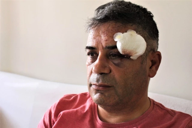 İYİ Parti Grup Başkan Vekili trafikte 4 kişinin saldırısına uğradı