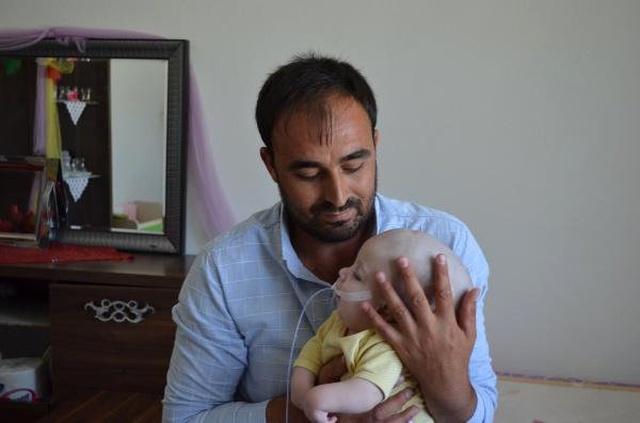1 yaşındaki Yunus Emre'nin beyni kafatasının dışında büyüyor! Çaresiz baba yardım bekliyor