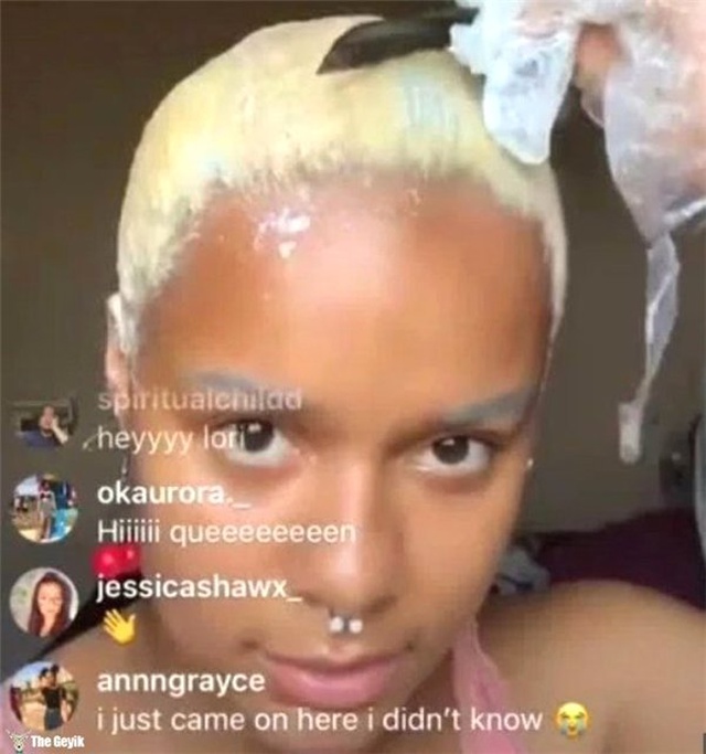Instagram Fenomeni Canlı Yayında Saçsız Kaldı