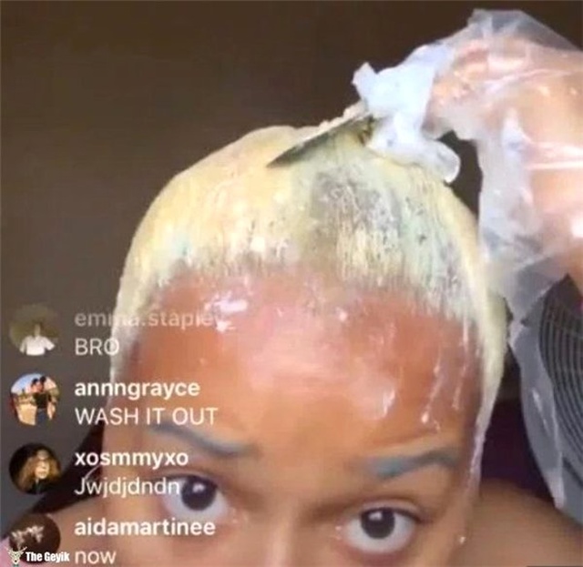 Instagram Fenomeni Canlı Yayında Saçsız Kaldı