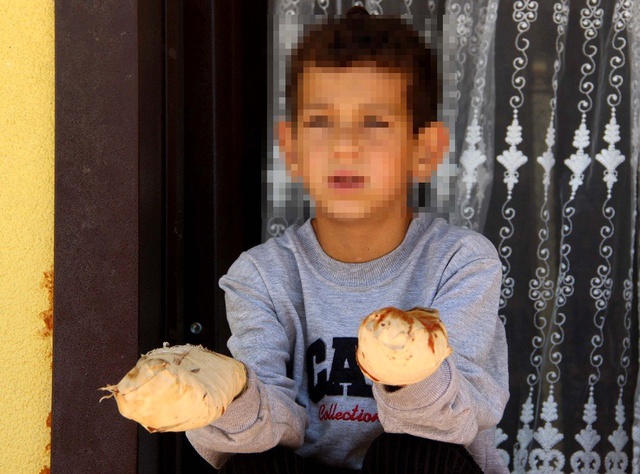 14 yaşındaki çocuk, oyun arkadaşının ellerini kolonya döküp çakmakla yaktı