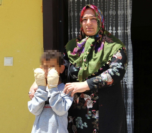 14 yaşındaki çocuk, oyun arkadaşının ellerini kolonya döküp çakmakla yaktı