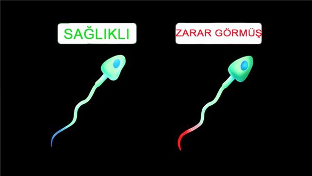 Bir Çalışma, WiFi'ın Erkeklerin Sperm Sayısını Düşürdüğünü Gösteriyor
