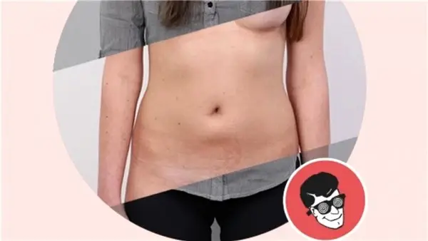 Hackerlar, Sahte DeepNude Uygulamasıyla Zararlı Yazılımlar Yaymaya Başladılar