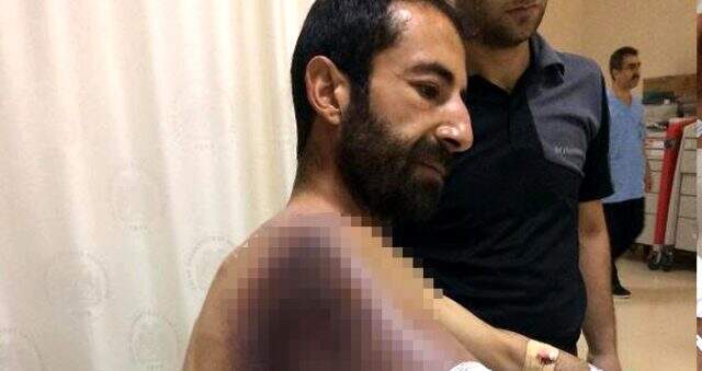 Taşla yaraladığı yılan ısırdı, hayati tehlikesi var Taşla yaraladığı yılan ısırdı, hayati tehlikesi var