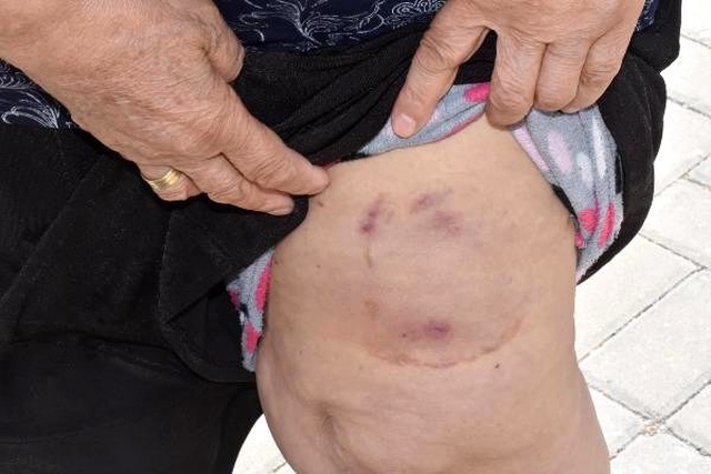 Pitbullun saldırdığı yaşlı kadın: Köpeğin bir suçu günahı yok
