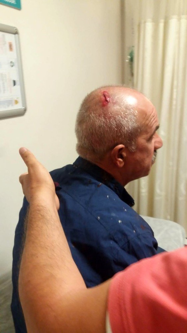Engelli kız ve babası, muhtar adayına oy verdiği için sopalarla darp edildi