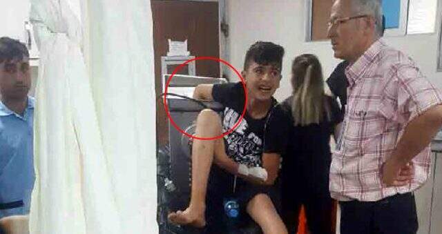 Gaziantep'te 14 yaşındaki çocuk elini kıyma makinesine kaptırdı