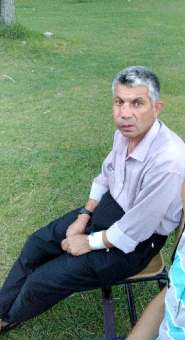 Dişini çektirmek için hastaneye giden adam, gözünden oldu!