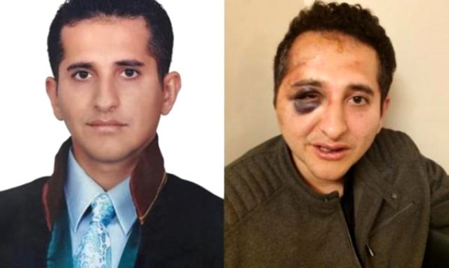 İstanbul Valiliği, Erdoğan'ın korumaları ile birlikte avukat Sertuğ Sürenoğlu'nu döven polisler için kararını verdi