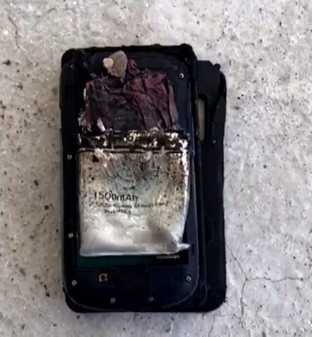 Uyumadan önce şarjda bıraktığı telefon patladı, talihsiz adamın bacağı parçalandı!