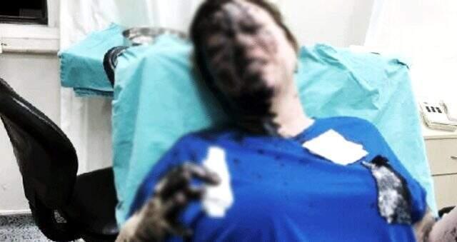 Adana'da iki kişi bir kadını darp edip, üzerine siyah renkli yanıcı madde döktü Adana'da iki kişi bir kadını darp edip, üzerine siyah renkli yanıcı madde döktü