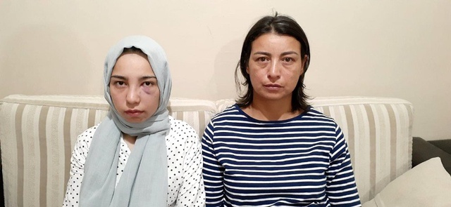 17 yaşındaki kızı köpek havlıyor diye acımasızca darp ettiler