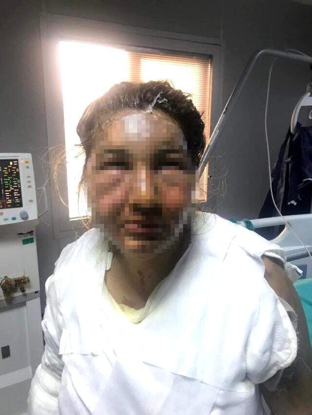 Cezaevinden izinli çıkan eski eş, genç kadını tanınmaz hale getirdi