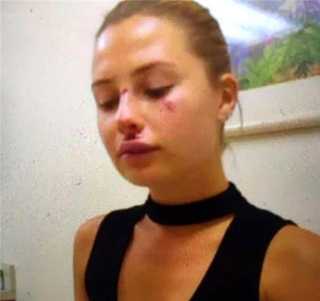 Serdar Ortaç'ın eski eşi Chloe Loughnan konuştu: Keşke kocam hastaneye gelseydi