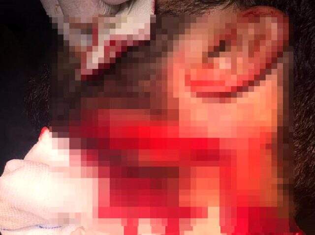 Hastası, asistan doktoru boğazından yaraladı