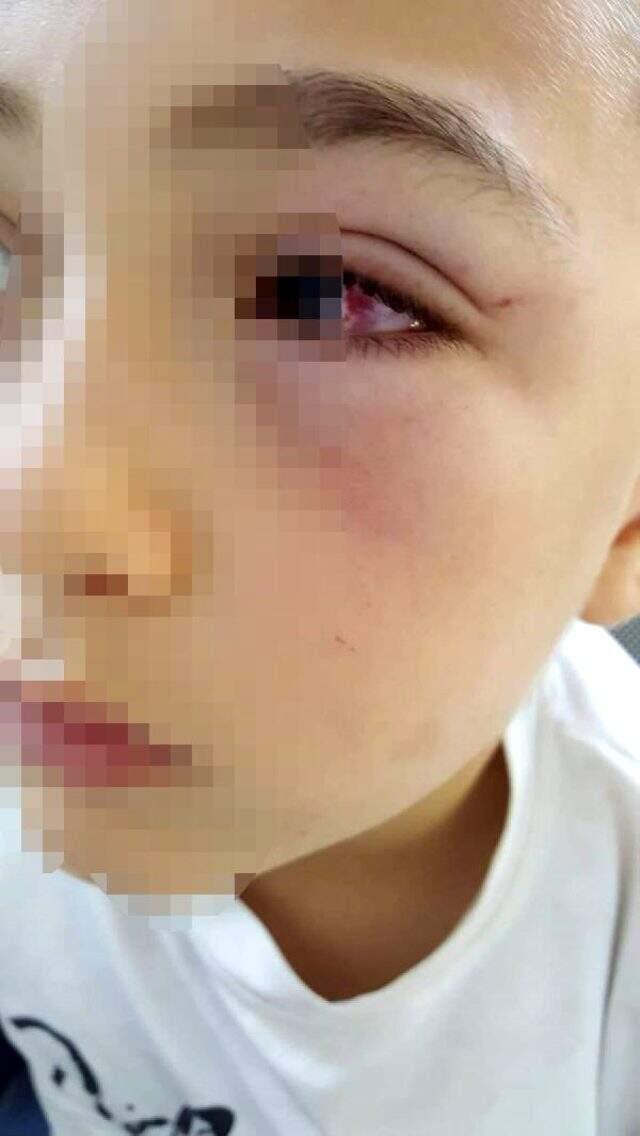 Öfkeli baba, çocuğuyla tartışan okul arkadaşını evine çağırıp yumrukla döverek hastanelik etti