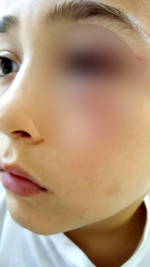 Öfkeli baba, oğlunun tartıştığı 9 yaşındaki çocuğu eve çağırıp yumrukla dövdü