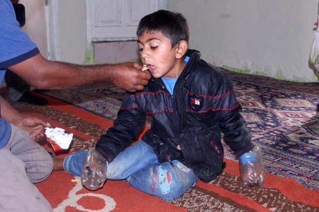 Minik Yusuf'un dramı: Sürekli ısırdığı ellerini plastik şişeye bağlıyorlar