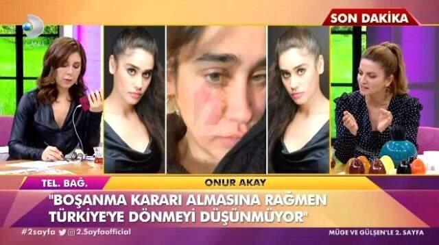 Boşanma kararı alan Meltem Miraloğlu 80 yaşındaki eşine 