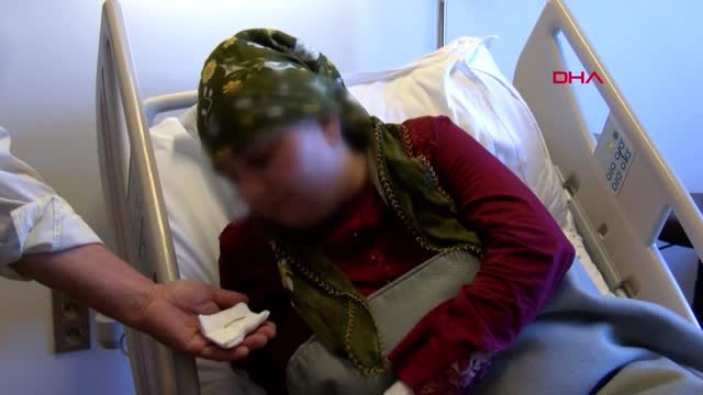 Yuttuğu dikiş iğnesiyle 16 yıl yaşadı