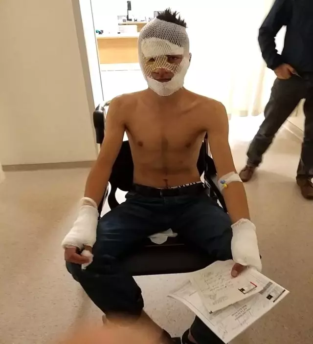 Kız kardeşini kaçıran kişinin evine yakmak isteyen ağabey, kendini yaktı