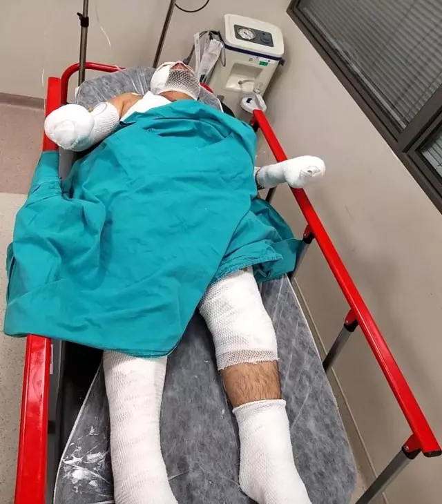 Kız kardeşini kaçıran kişinin evine yakmak isteyen ağabey, kendini yaktı