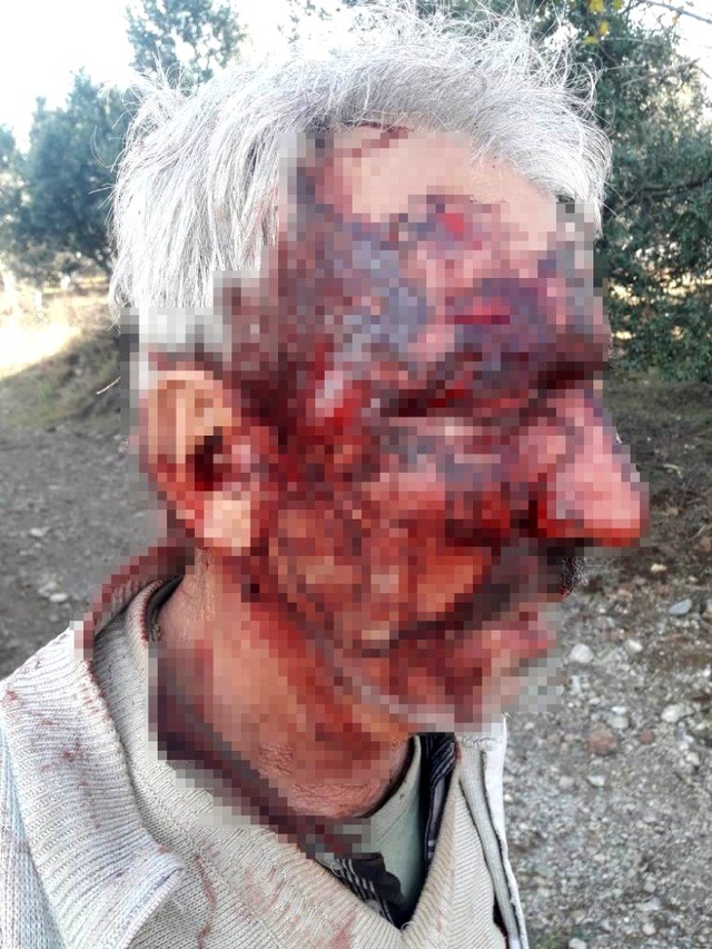 Sınır meselesi yüzünden kavga ettiği komşusu engelli vatandaşı dövüp çukura attı