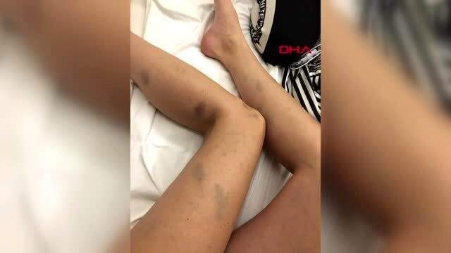 Model sevgilisini dövdüğü iddiasıyla dava açılan yönetmen hakim karşısına çıktı