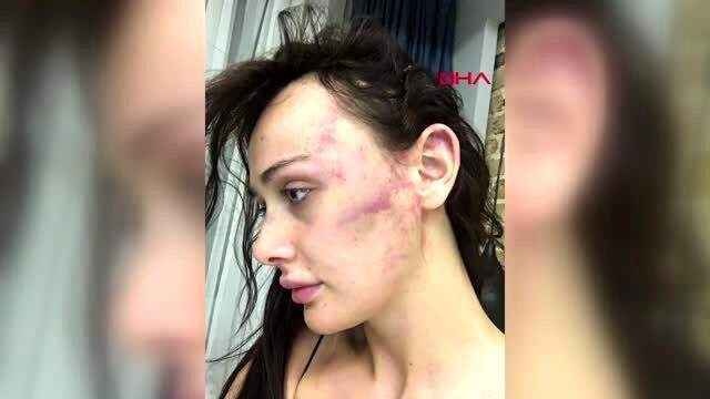 Model sevgilisini dövdüğü iddiasıyla dava açılan yönetmen hakim karşısına çıktı