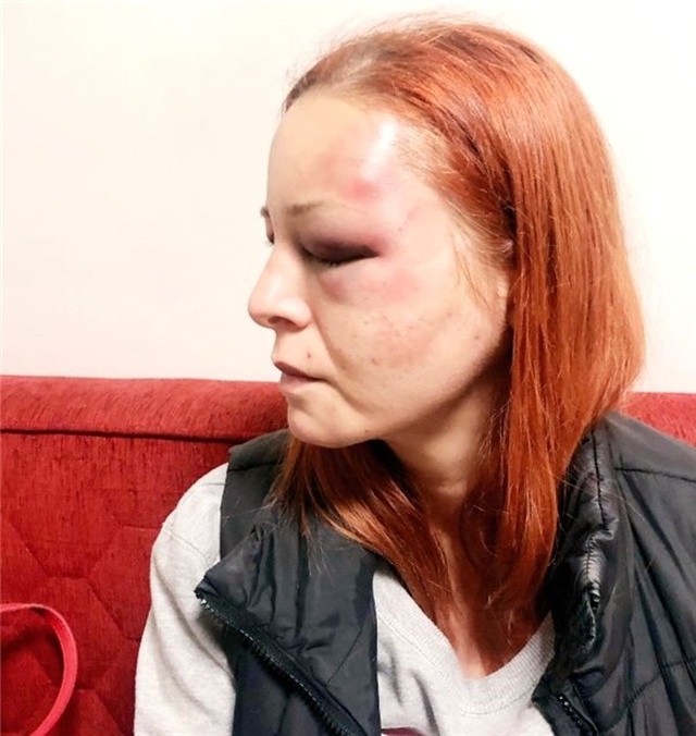 Deniz Soysal: Bir işkenceciden nasıl kurtulunur? Fotoğraflarıma iyice bakın...