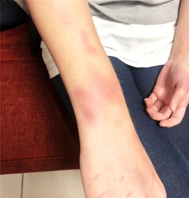 Deniz Soysal: Bir işkenceciden nasıl kurtulunur? Fotoğraflarıma iyice bakın...