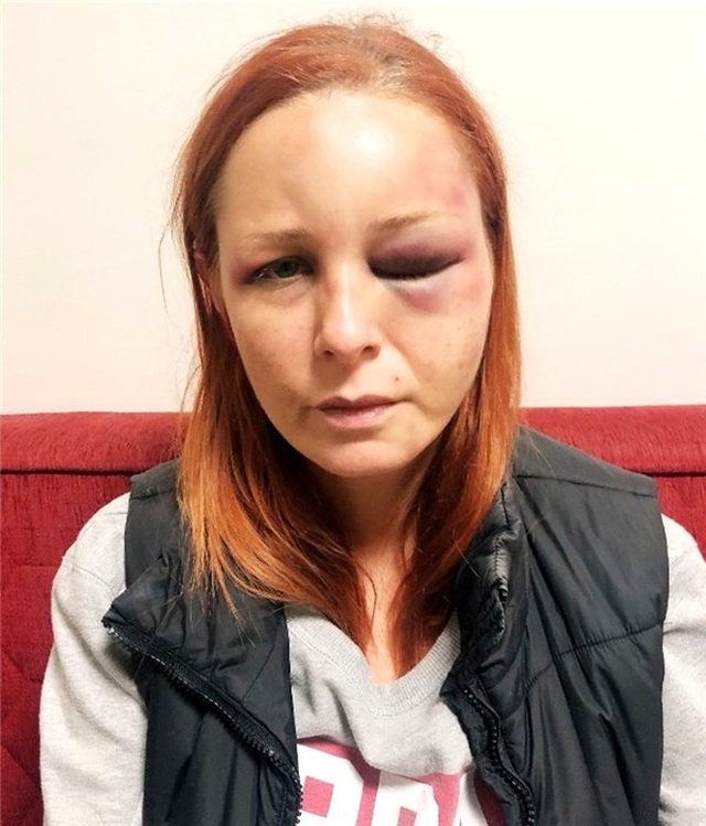 Deniz Soysal: Bir işkenceciden nasıl kurtulunur? Fotoğraflarıma iyice bakın...