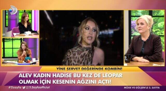 Hadise, Kim Kardashian kalçasına sahip olmak için bıçak altına yattı