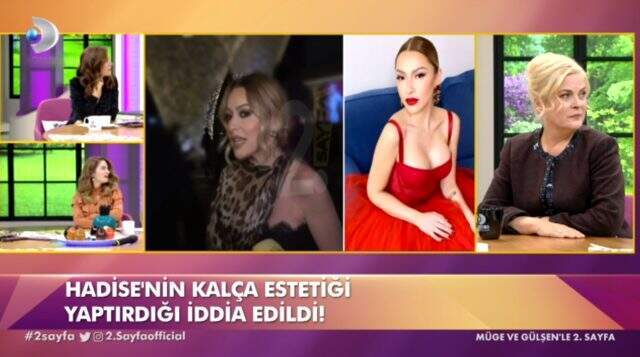 Hadise, Kim Kardashian kalçasına sahip olmak için bıçak altına yattı