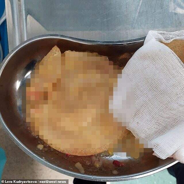 48 yaşındaki Rus sunucu Lera Kudryavtseva patlayan silikonlarının fotoğrafını paylaştı 48 yaşındaki Rus sunucu Lera Kudryavtseva patlayan silikonlarının fotoğrafını paylaştı