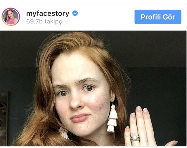 Instagram Fenomenlerinden Güzel Görüntüye Kanmayın Temalı 5 Fotoğraf