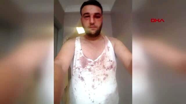 Babasını ziyaret etmek isteyen şahıs, hastane güvenlikleri tarafından dövüldü Babasını ziyaret etmek istedi, yediği dayak sonrası hafızasını kaybetti