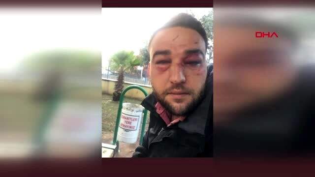 Babasını ziyaret etmek isteyen şahıs, hastane güvenlikleri tarafından dövüldü Babasını ziyaret etmek istedi, yediği dayak sonrası hafızasını kaybetti