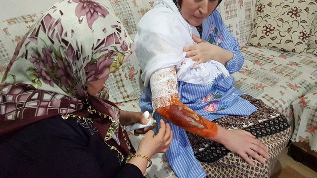 Cani koca 'misafirin yanında oturmadı' diye eşini kaynar su ile haşlandı