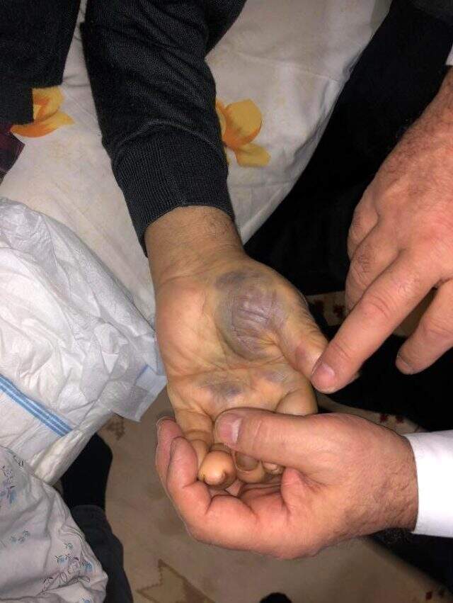 94 yaşındaki şahsın gündüz eve gelen bakıcısı korkunç manzarayla karşılaştı! Hemen polisi aradı