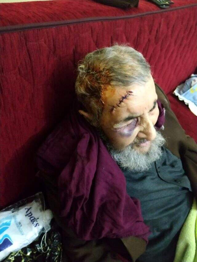 94 yaşındaki şahsın gündüz eve gelen bakıcısı korkunç manzarayla karşılaştı! Hemen polisi aradı