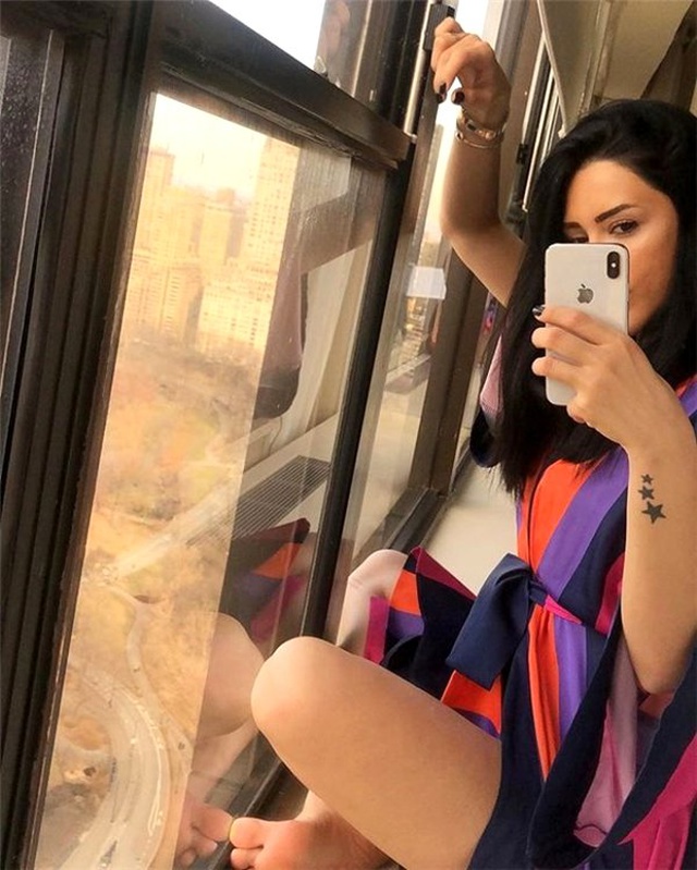Bu Tarz Benim'in Ayşegül'ü de Estetik Yaptırmış, İşte Yeni Hali