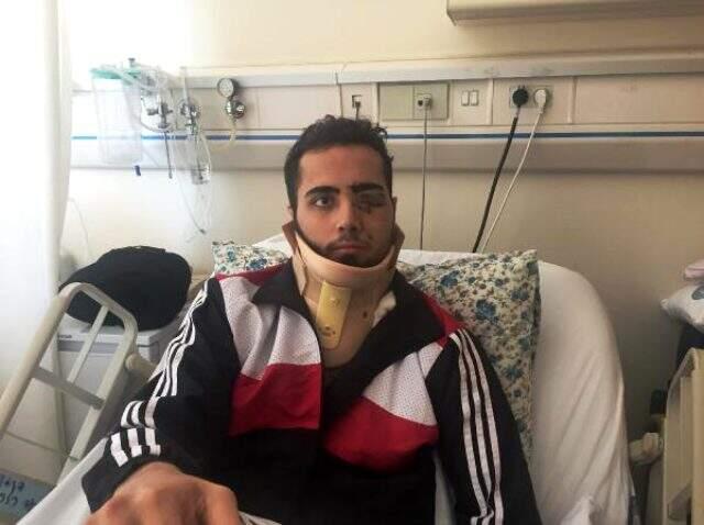 Yüzüne demir saplanan Emre, yoğun bakımdan çıktı